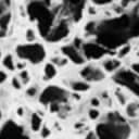 DEXA scan (low-dose radiation)